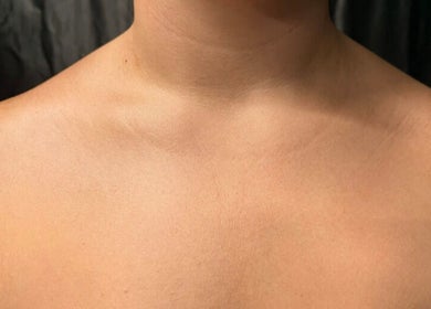 Close-up of a smooth neck and shoulders for X&O Beauty Co (MOBILE SERVICE) in Kalkallo, Victoria, AU.