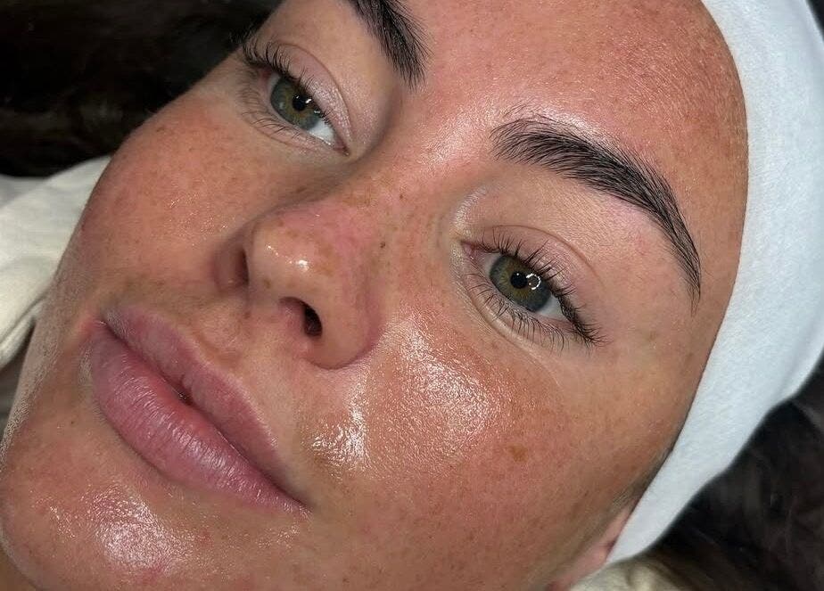 Close-up of refreshed skin after brow treatment at Custom Brow Studio in Swinton, England, GB.