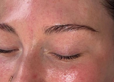 Facial skincare results at Anike Aesthetics & Beauty, Radcliffe, England, GB. Smooth, glowing skin post-treatment.