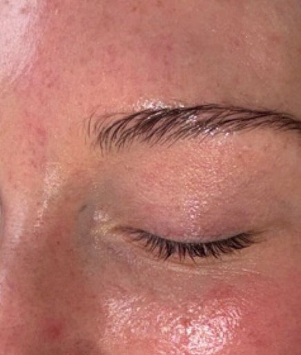Facial skincare results at Anike Aesthetics & Beauty, Radcliffe, England, GB. Smooth, glowing skin post-treatment.