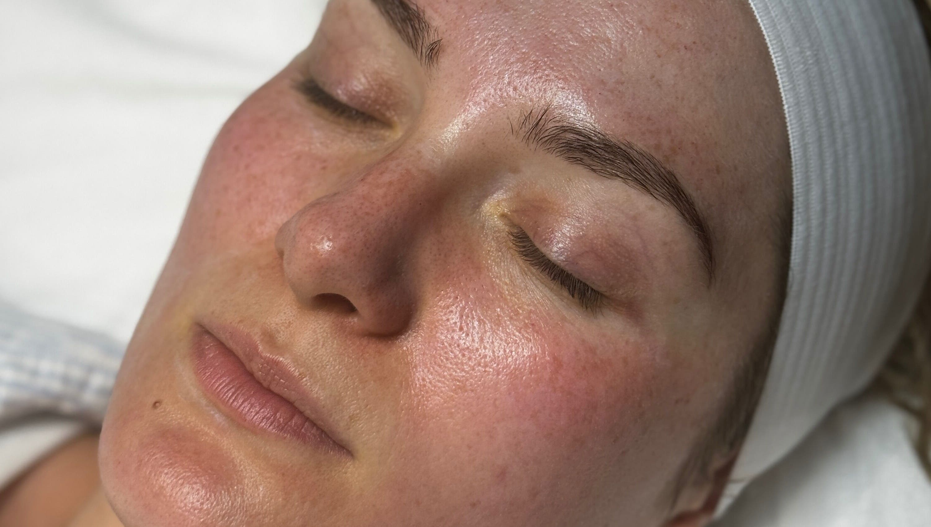 Relaxed face with glowing skin at Aura Nova Aesthetics & Beauty, Royal Tunbridge Wells, England, GB.