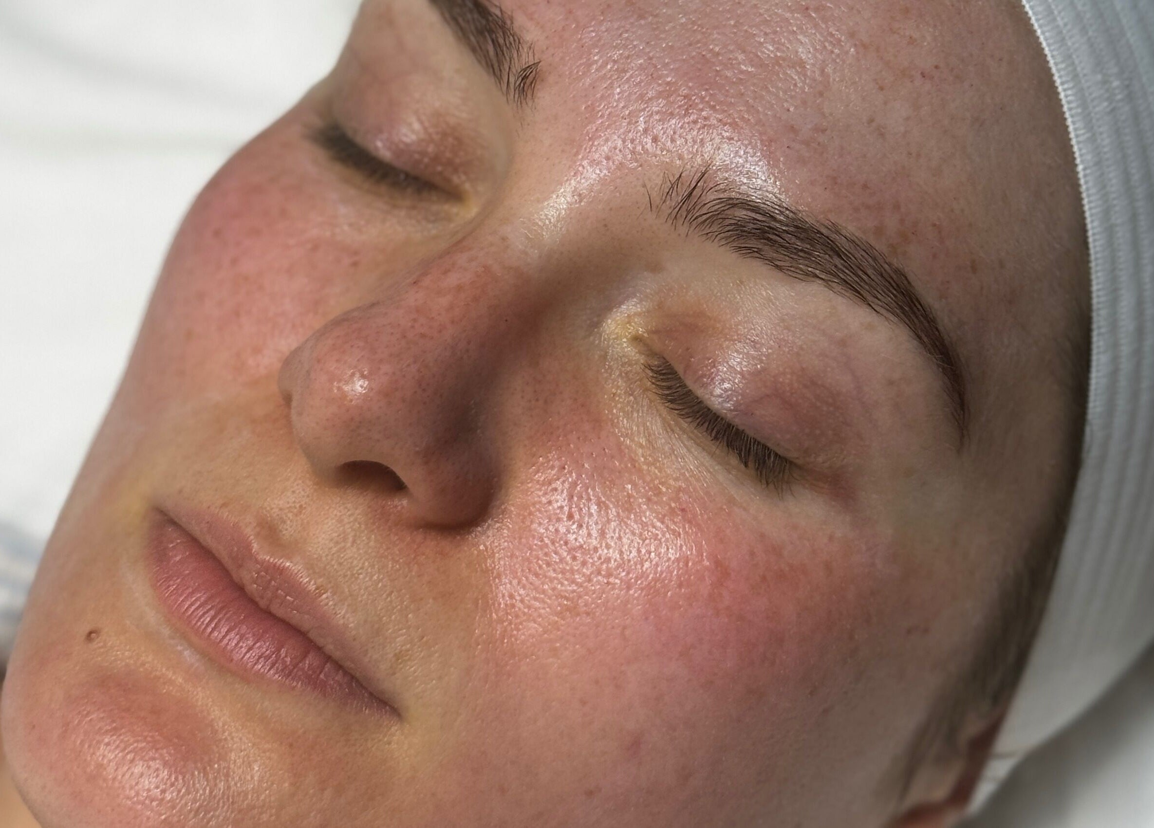 Relaxed face with glowing skin at Aura Nova Aesthetics & Beauty, Royal Tunbridge Wells, England, GB.