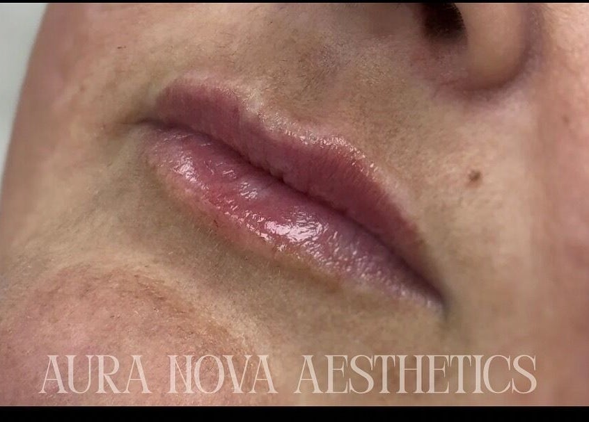 Glossy lips treatment at Aura Nova Aesthetics & Beauty, Royal Tunbridge Wells, England, GB.