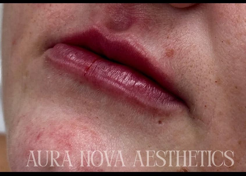 Close-up of radiant lips showcasing beauty results at Aura Nova Aesthetics & Beauty, Royal Tunbridge Wells, England, GB.