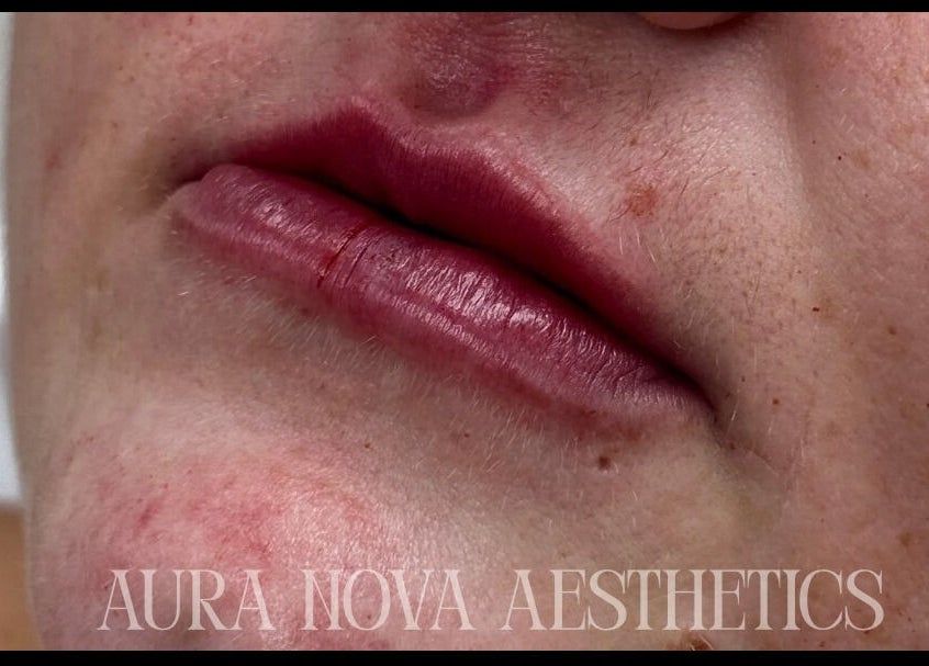 Close-up of radiant lips showcasing beauty results at Aura Nova Aesthetics & Beauty, Royal Tunbridge Wells, England, GB.