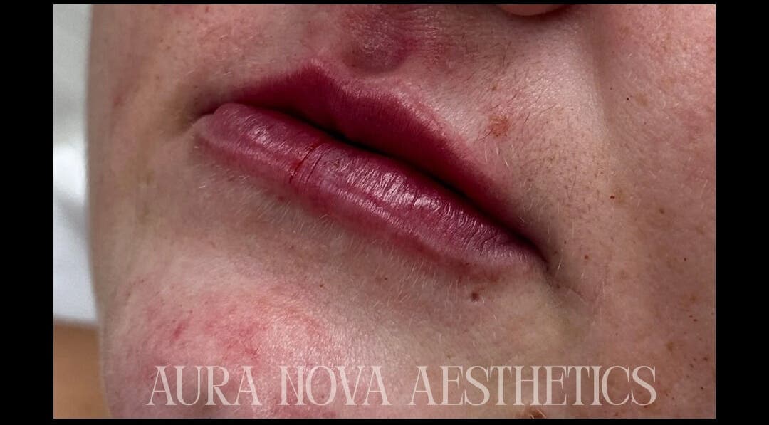 Close-up of radiant lips showcasing beauty results at Aura Nova Aesthetics & Beauty, Royal Tunbridge Wells, England, GB.