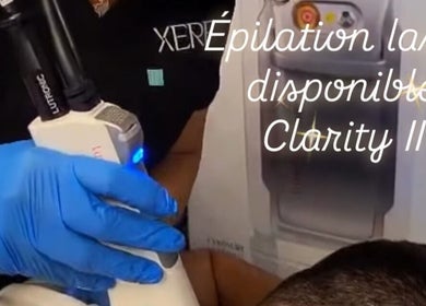 Épilation laser à Odyssee derme, Brossard, Québec, CA.