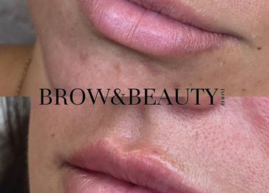 Close-up of enhanced lips at Brow & Beauty, Mansfield, England, GB, showcasing smooth, glowing skin.