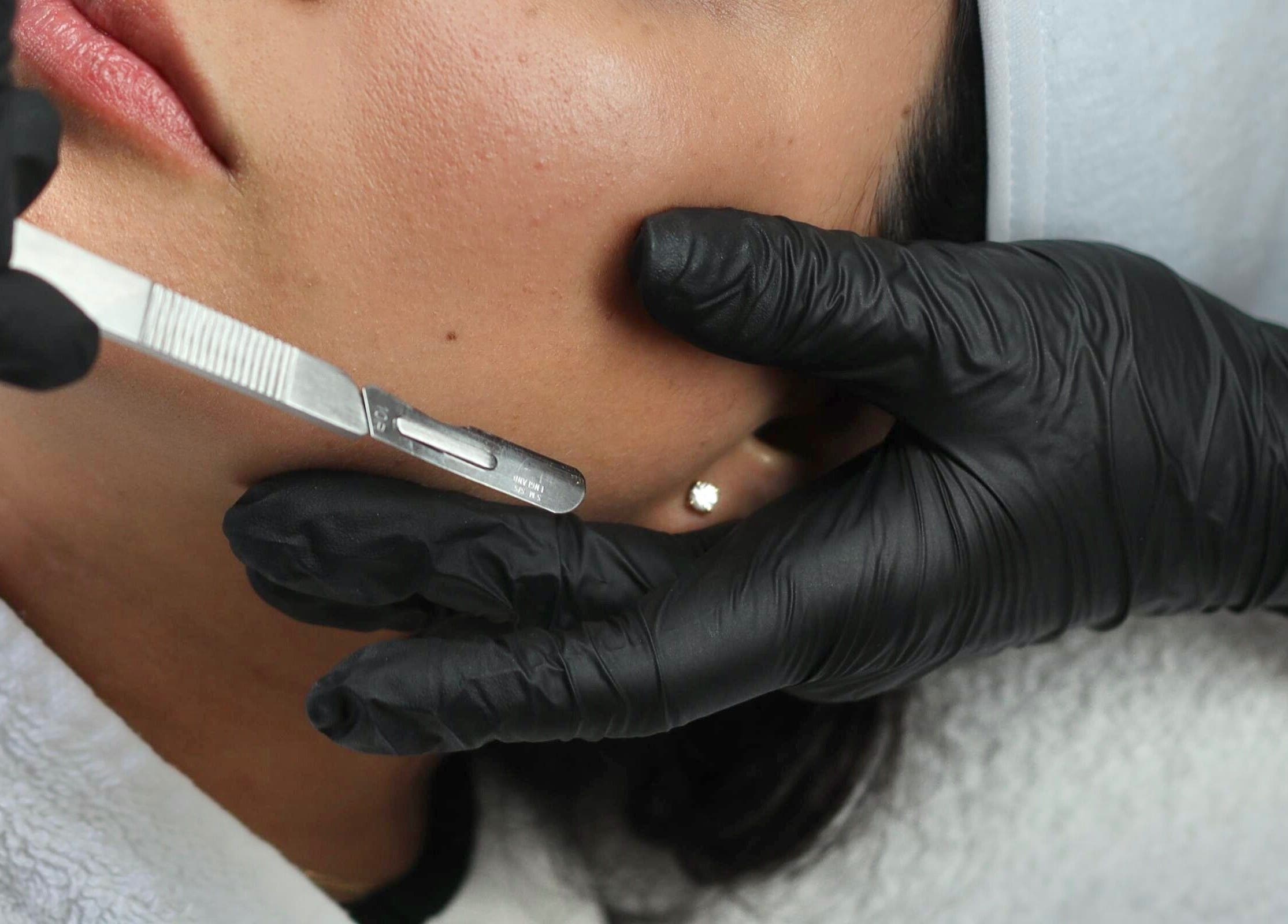 Gezichtsbehandeling bij Bless Esthetic Leuven, Leuven, Vlaanderen, BE, met precisie en zorg uitgevoerd.