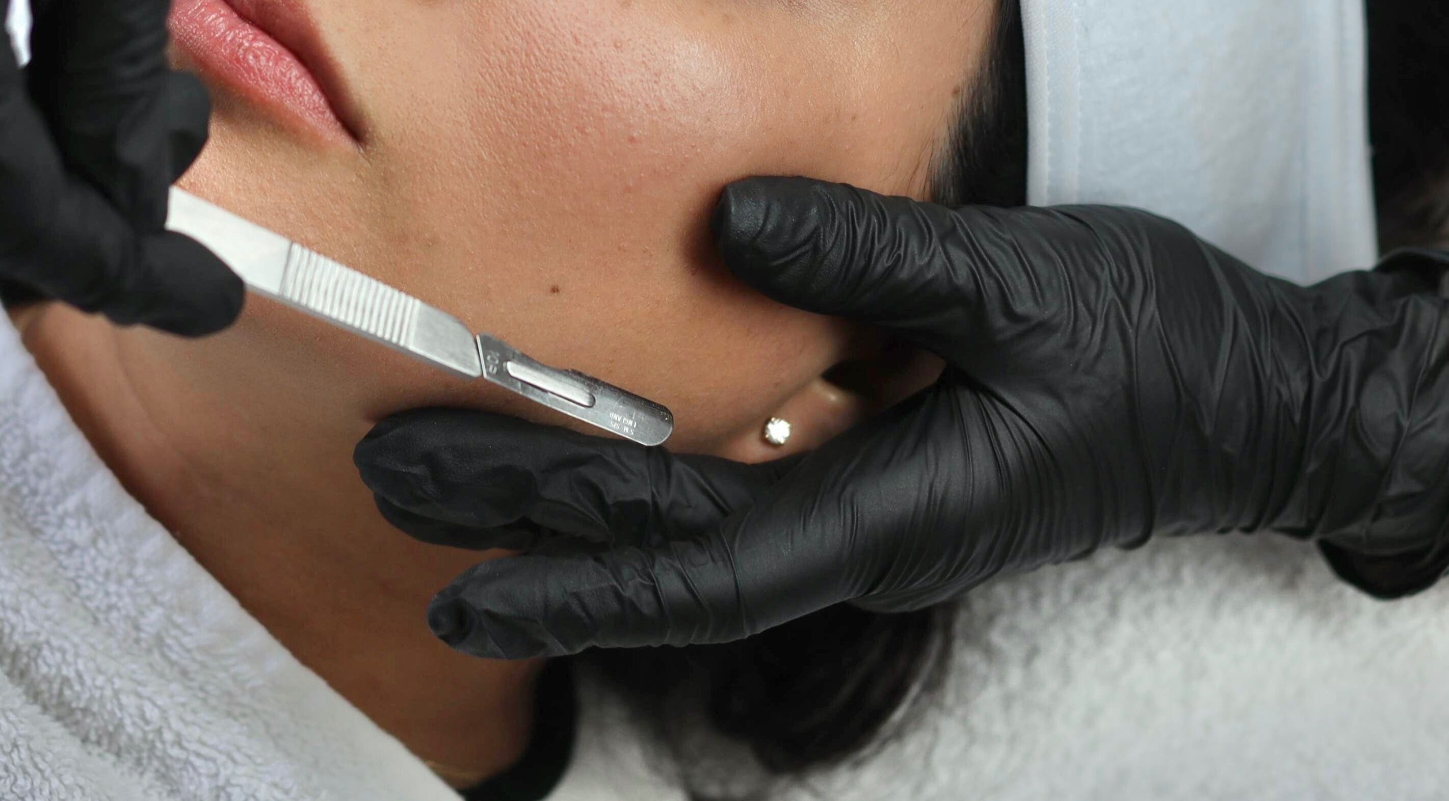 Gezichtsbehandeling bij Bless Esthetic Leuven, Leuven, Vlaanderen, BE, met precisie en zorg uitgevoerd.