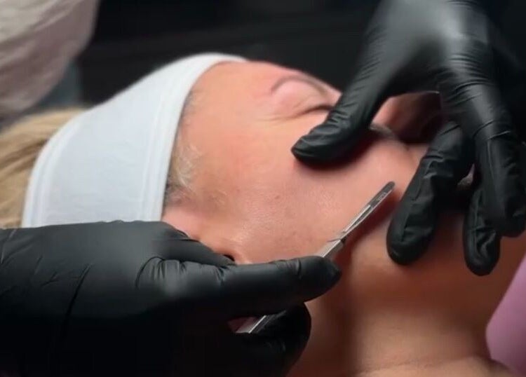 Professionele dermaplaning bij Bless Esthetic Tremelo, Tremelo, Vlaams Gewest, BE voor een stralende huid.