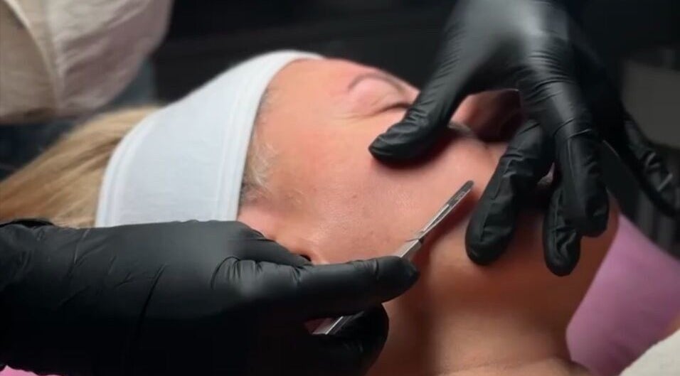 Professionele dermaplaning bij Bless Esthetic Tremelo, Tremelo, Vlaams Gewest, BE voor een stralende huid.