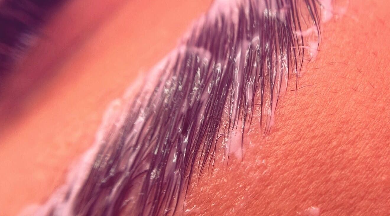 Close-up of brow treatment at MLG Extensions, Watford, England, GB, showing precision in detailing and care.