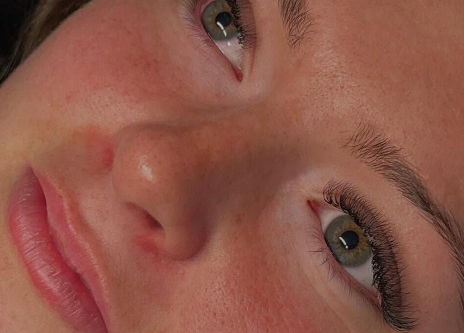 Close-up of a client's radiant face after treatment at Golden Beauty Bar, Peats Ridge, New South Wales, AU.