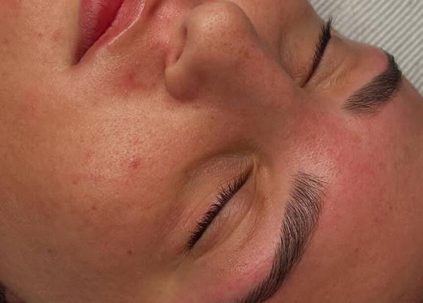 Close-up of a relaxed face post-facial at Golden Beauty Bar, Peats Ridge, New South Wales, AU.