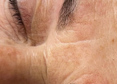 Close-up of a client's treated eye area at Lina Holistics & Beauty in Stoke-on-Trent, England, GB.