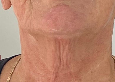 Close-up of a neckline at The Sculpt Studio EST 2018, Sketty, Wales, GB, showcasing skin texture.