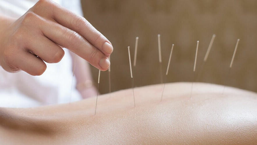 Palms Acupuncture and Wellness image 1