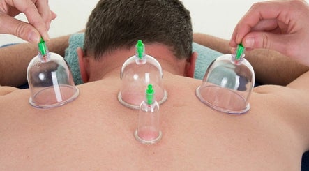 Palms Acupuncture and Wellness image 2