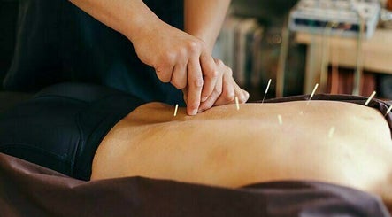 Palms Acupuncture and Wellness image 3