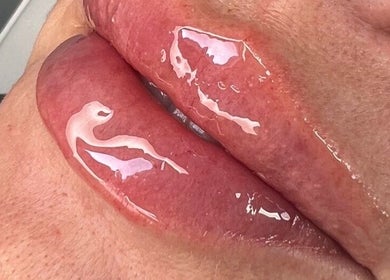 Close-up of glossy lips treated at Skinfinity Aesthetics Phenix Suites, Liverpool, England, GB.