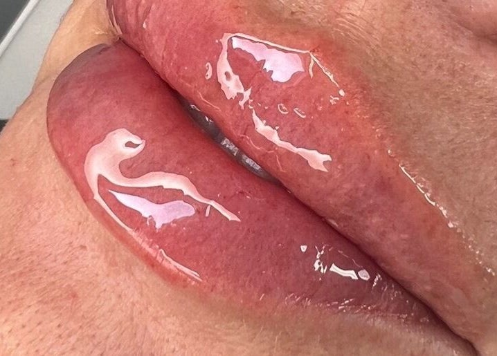 Close-up of glossy lips treated at Skinfinity Aesthetics Phenix Suites, Liverpool, England, GB.