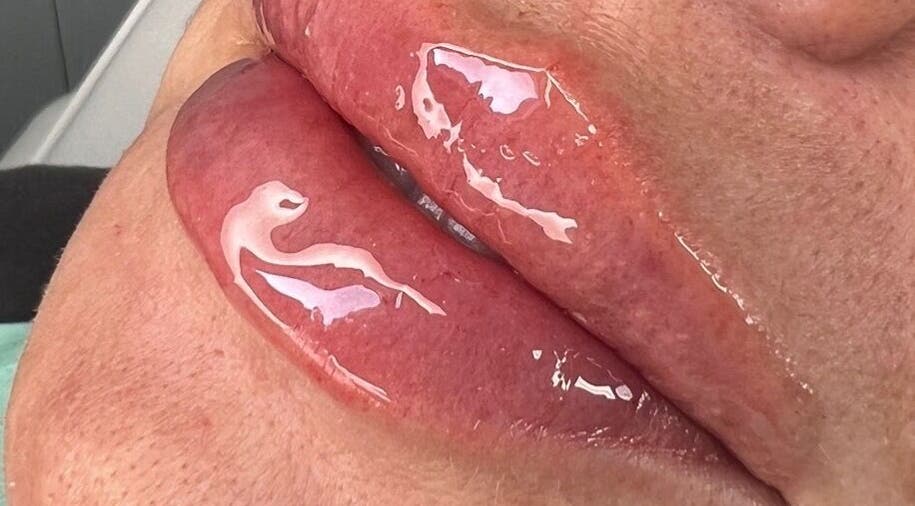 Close-up of glossy lips treated at Skinfinity Aesthetics Phenix Suites, Liverpool, England, GB.