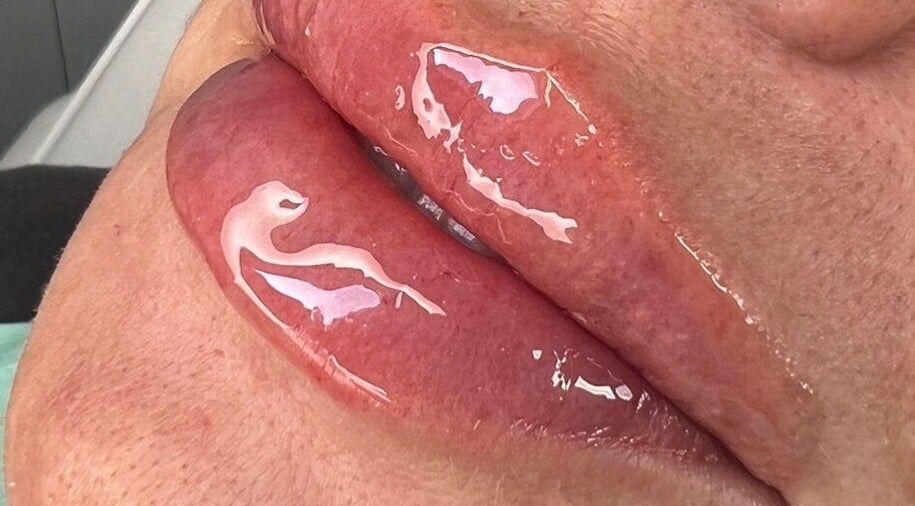 Close-up of glossy lips treated at Skinfinity Aesthetics Phenix Suites, Liverpool, England, GB.