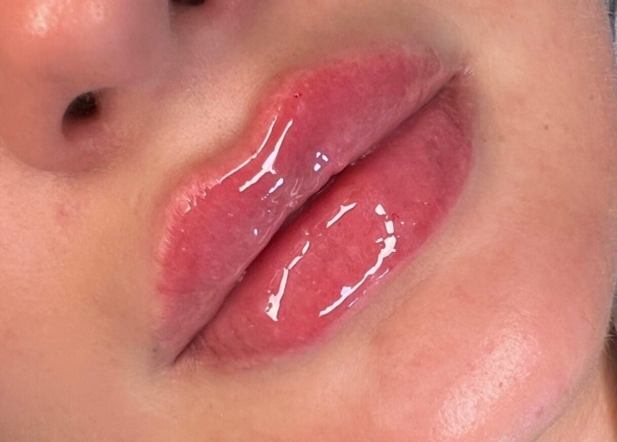 Close-up of glossy lips treatment at Skinfinity Aesthetics Phenix Suites in Liverpool, England, GB.