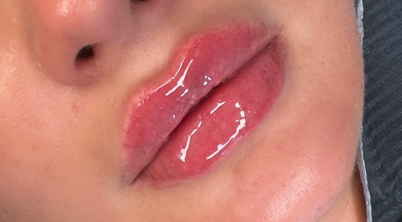 Close-up of glossy lips treatment at Skinfinity Aesthetics Phenix Suites in Liverpool, England, GB.