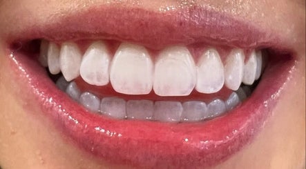 Image de Chrystal Clear Smile - Earlwood Salon 3