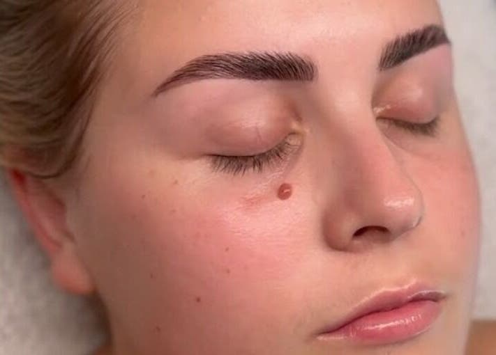 Relaxed face after treatment at Serene Skin & Body, Mount Hutton, New South Wales, AU.