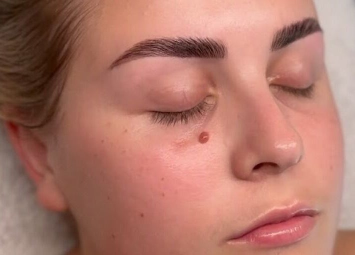 Relaxed face after treatment at Serene Skin & Body, Mount Hutton, New South Wales, AU.