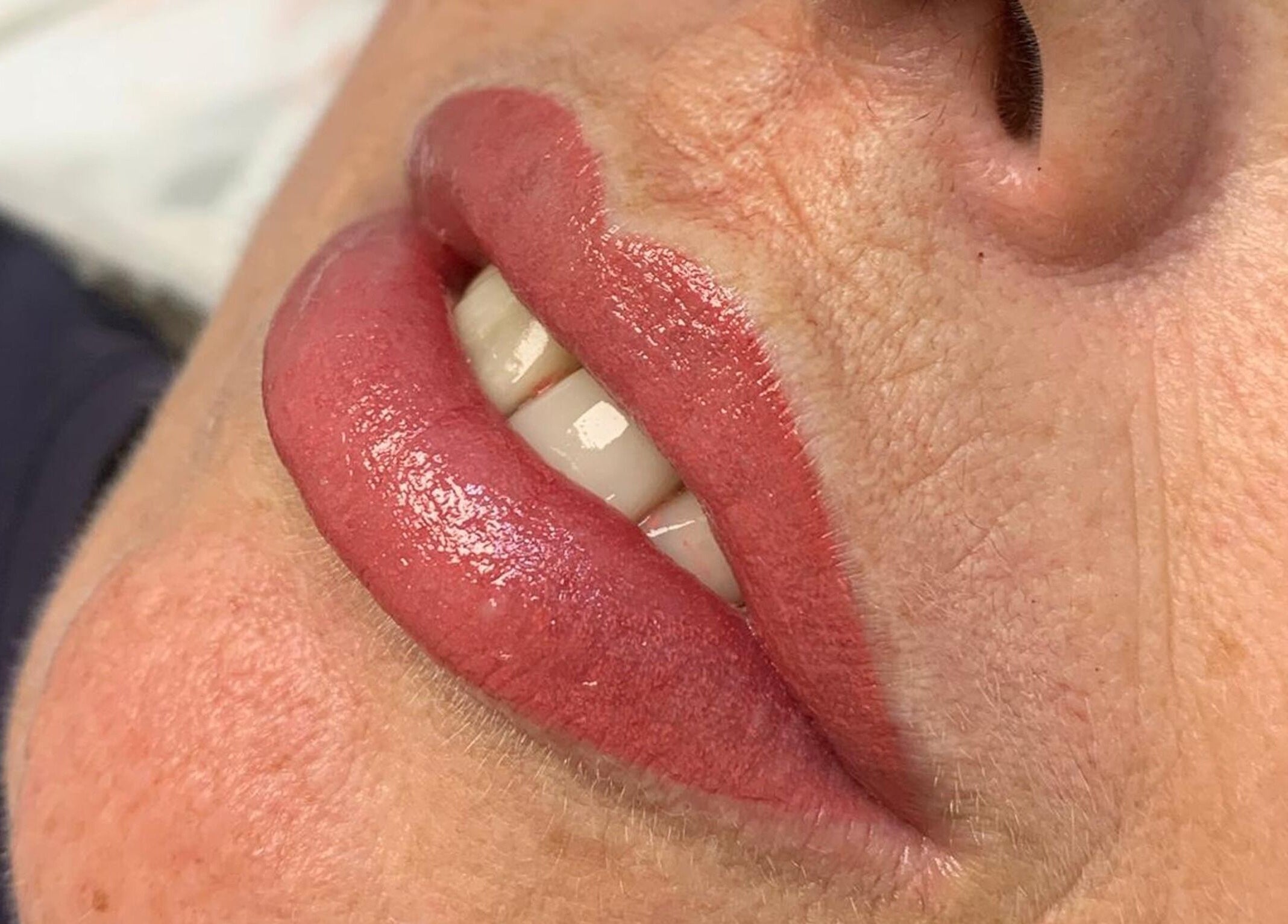 Close-up of beautiful enhanced lips at Classic Beauty Boutique, Bournemouth, England, GB.