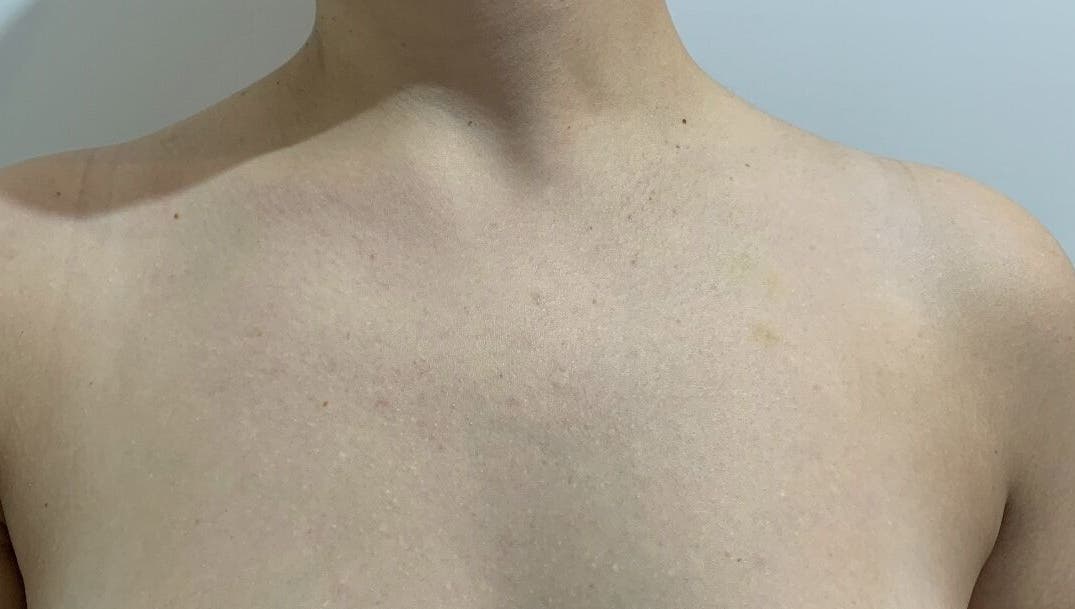 Smooth skin detail captured at Beauty by Kaycee, Melbourne, Victoria, AU, showcasing subtle complexion beauty.