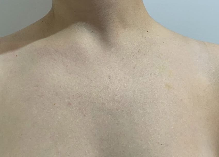 Smooth skin detail captured at Beauty by Kaycee, Melbourne, Victoria, AU, showcasing subtle complexion beauty.