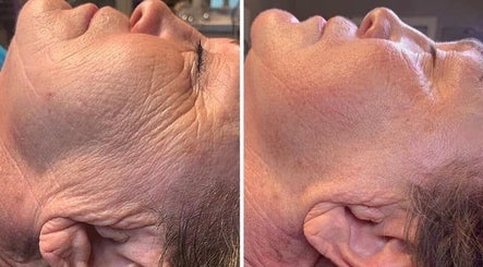 Renouvelle Esthetic Levittown