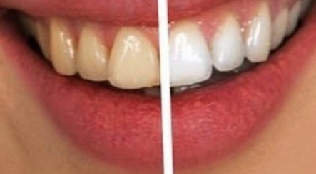 The Smile Restore Dental Clinics (Accra Branch) Bild 3