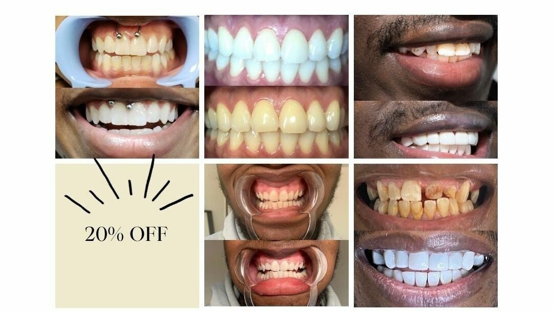 The Smile Restore Dental Clinics (East Legon Branch) - 1