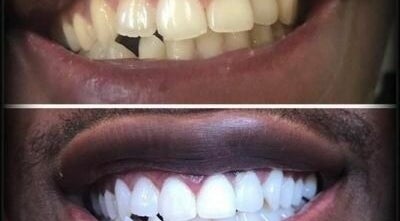 The Smile Restore Dental Clinics (East Legon Branch) afbeelding 3