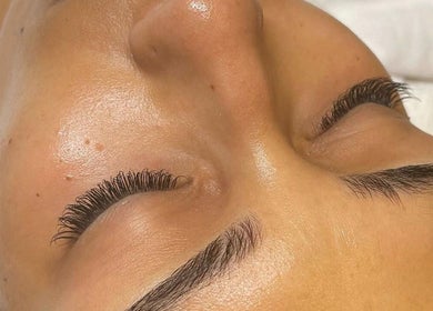 Close-up of a woman's serene face receiving a beauty treatment at LB Aesthetic in New York, New York, US.