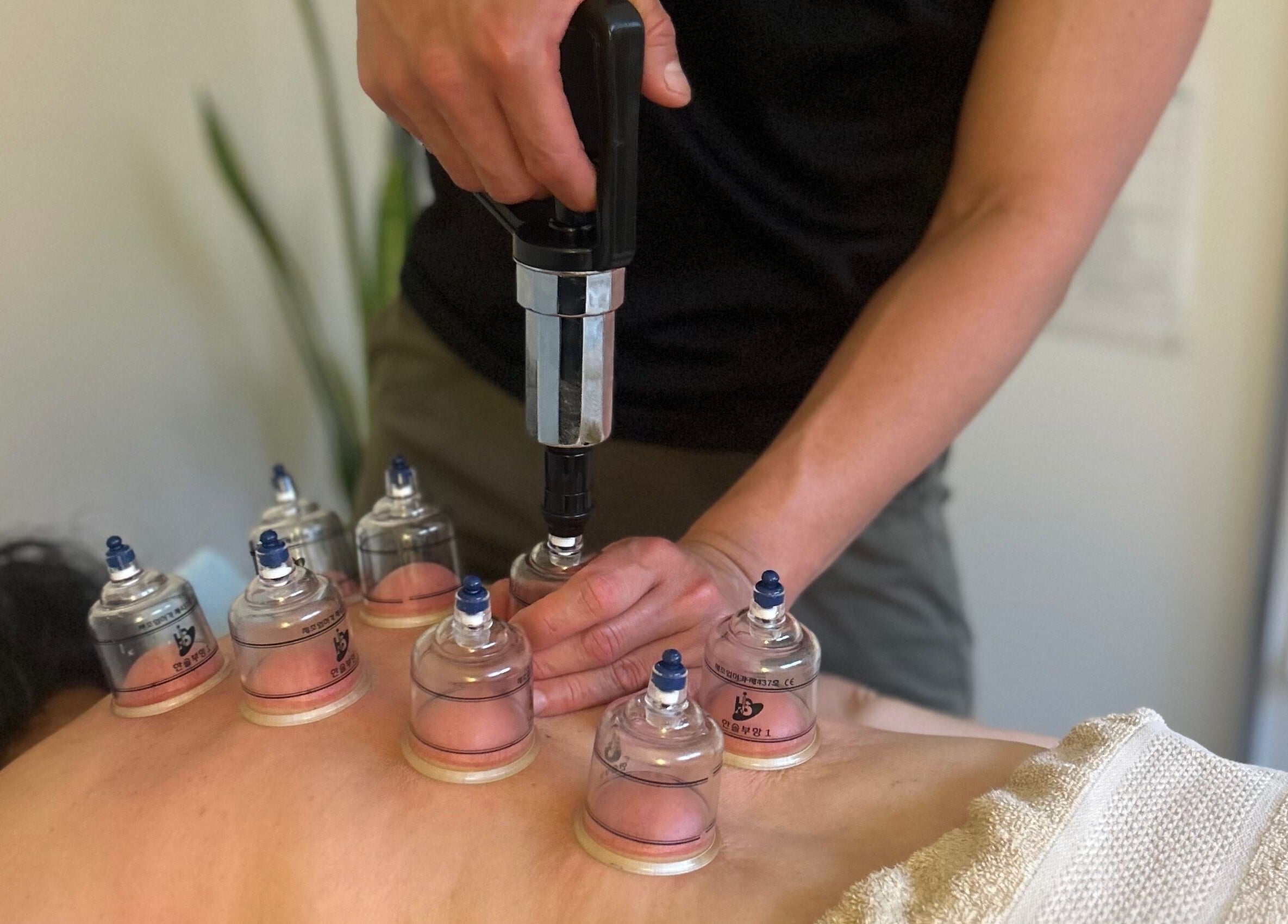 Relaxing cupping therapy at Move With Jase, Dianella, Western Australia, AU. Experience wellness and rejuvenation.