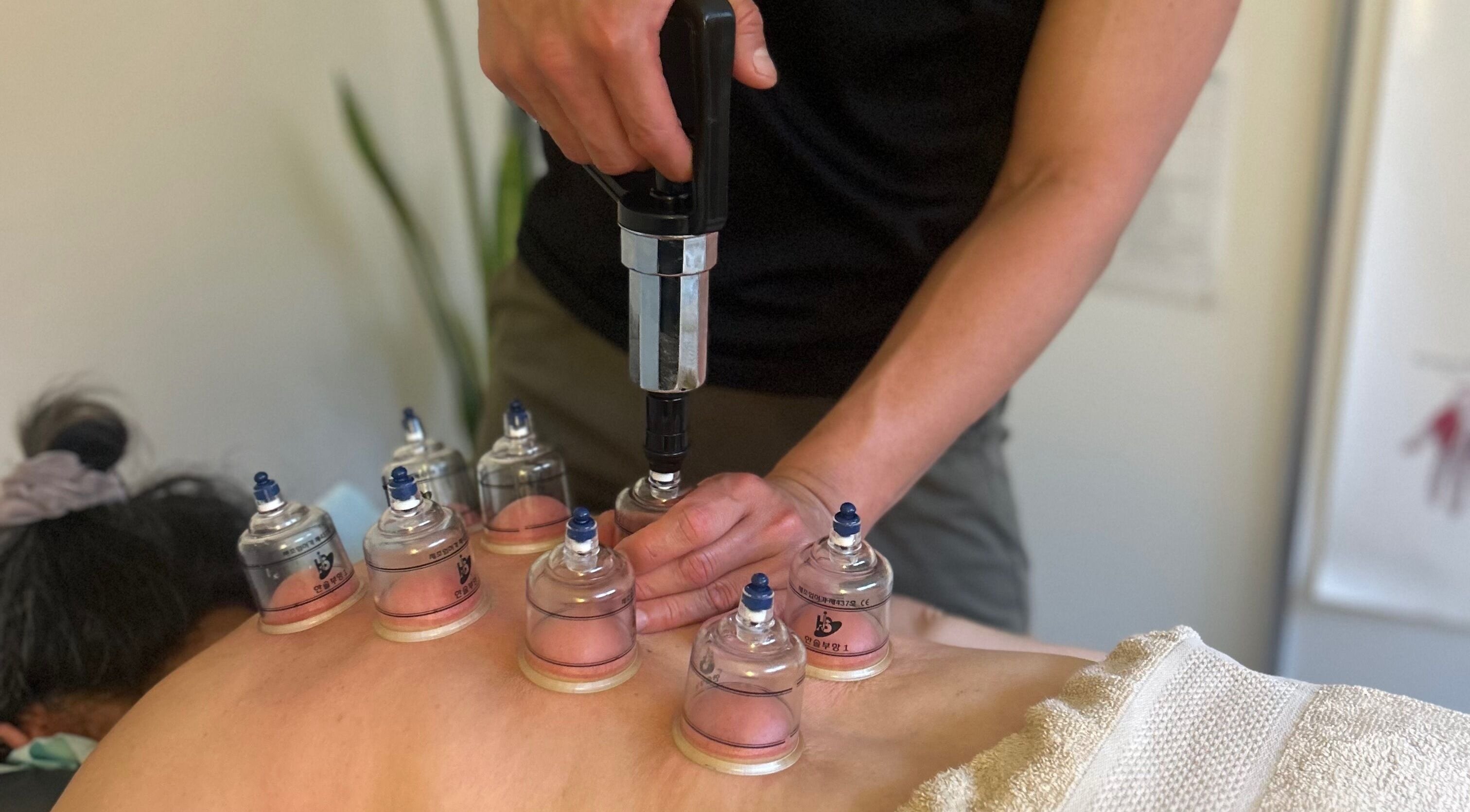 Relaxing cupping therapy at Move With Jase, Dianella, Western Australia, AU. Experience wellness and rejuvenation.