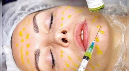 Facial rejuvenation treatment at Marie Randall Skin Clinic, Syston, England, GB, enhancing skin vitality.