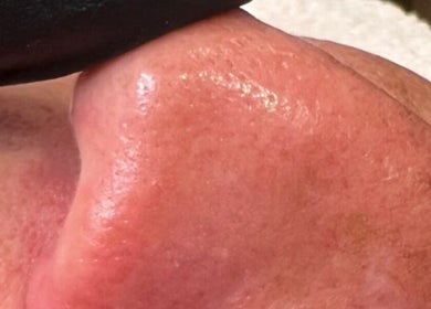A close-up view of a glowing skin treatment at Beauty By Anna Ashley at Beauty & Co, Abbot’s Langley, GB.