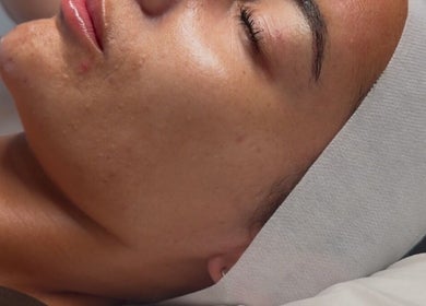 A serene client enjoys a facial treatment at The Contour Clinic, Irlam, England, GB.