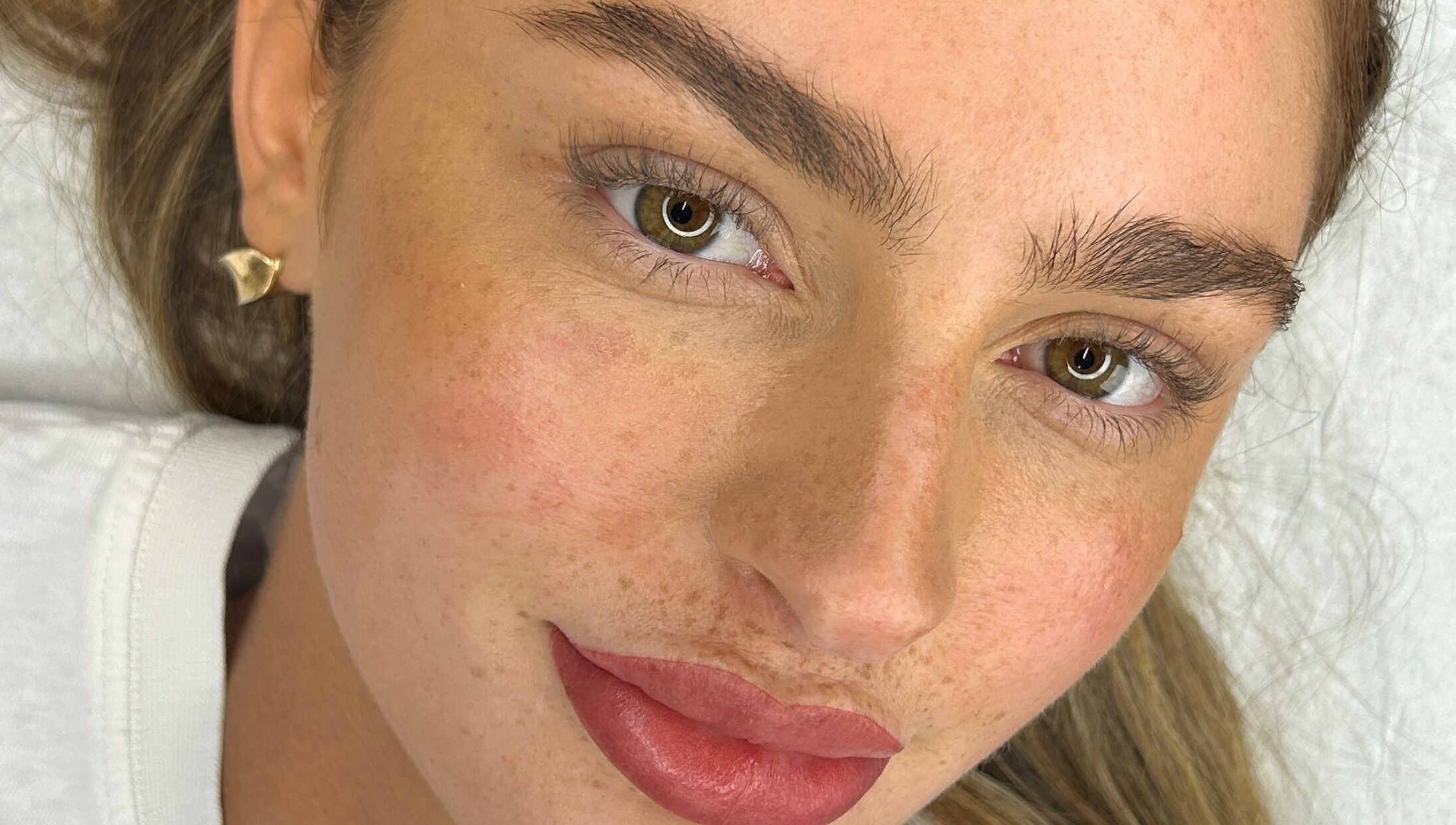 Close-up of a radiant face after treatment at Aestheticá by Phoebe White, Newport, Wales, GB.