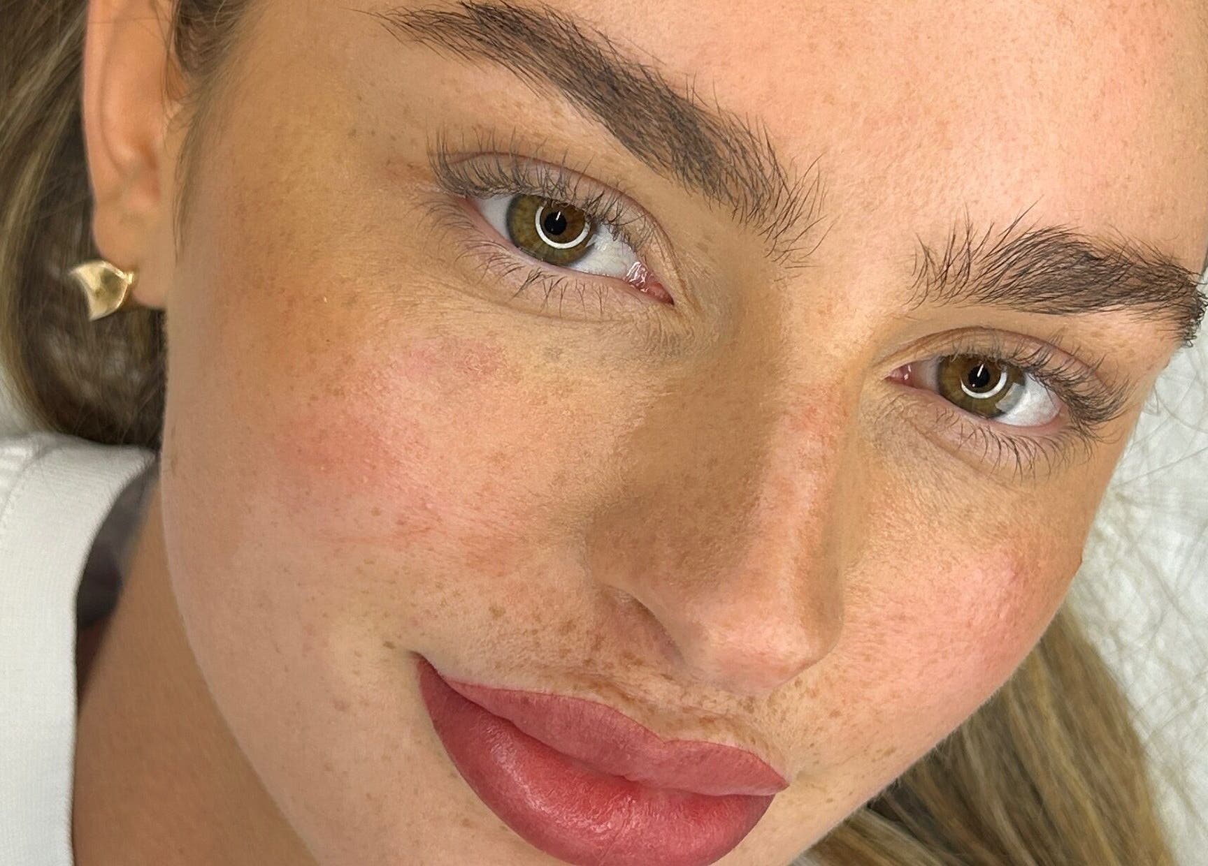 Close-up of a radiant face after treatment at Aestheticá by Phoebe White, Newport, Wales, GB.