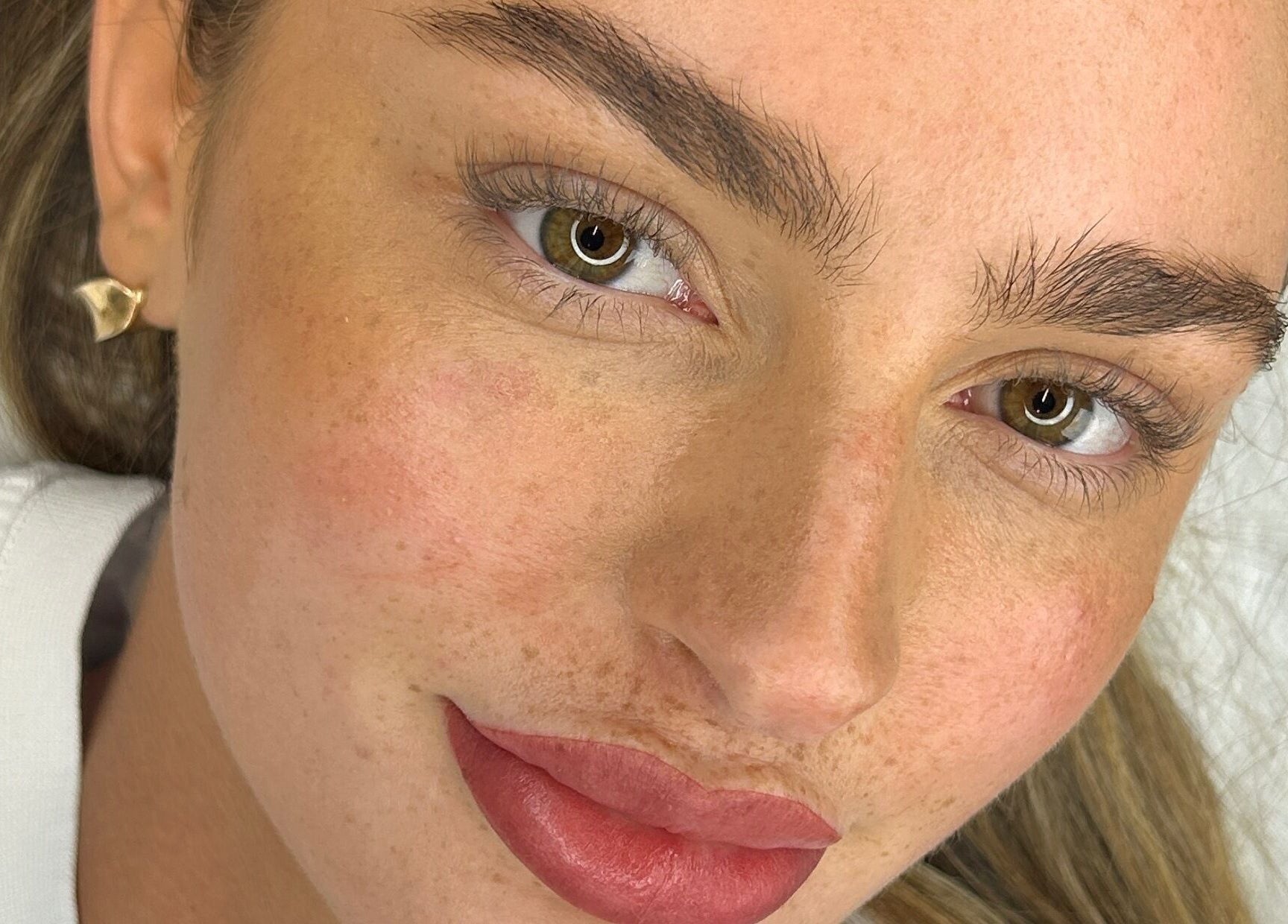 Close-up of a radiant face after treatment at Aestheticá by Phoebe White, Newport, Wales, GB.