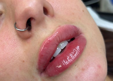 Close-up of glossy lips treatment at Gabrielle Aesthetics, Lichfield, England, GB.